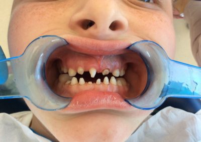 Development Anomalies Before Treatment