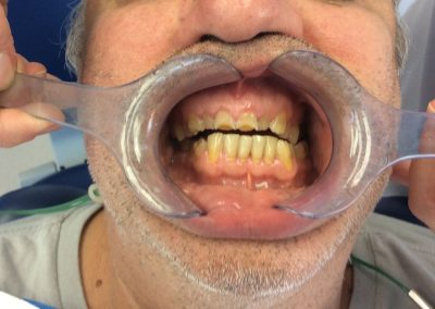 Rehabilitation Before Treatment