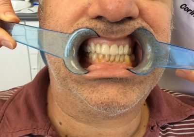 Rehabilitation AfterTreatment